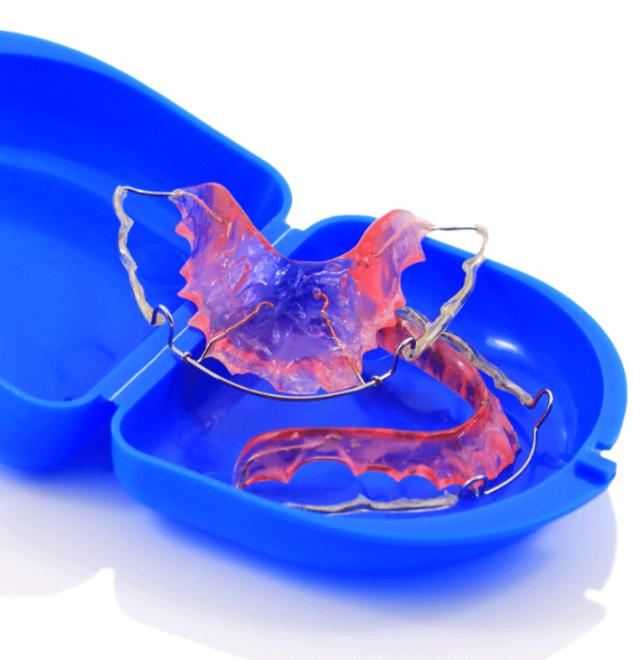 A pair of colorful dental retainers, pink and purple, placed in a blue plastic case, used for orthodontic maintenance to keep teeth aligned after braces.
